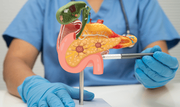 Pancreatic Cancer